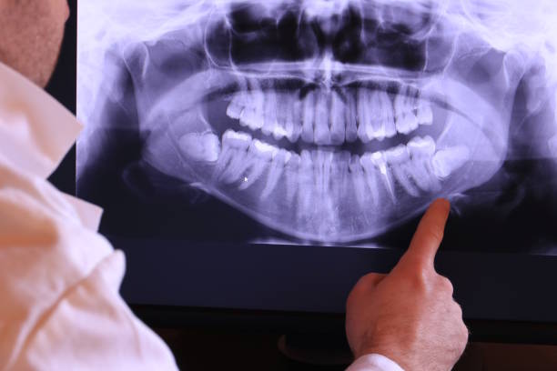 Best Emergency TMJ Treatment in Nazareth, PA